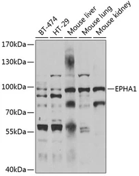Anti-EphA1 antibody used in Western Blot (WB). GTX55605