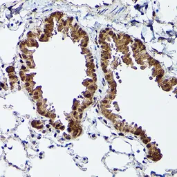 Anti-ERK5 antibody used in IHC (Paraffin sections) (IHC-P). GTX55608