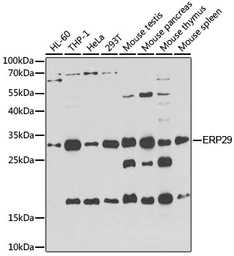 Anti-ERP29 antibody used in Western Blot (WB). GTX55609