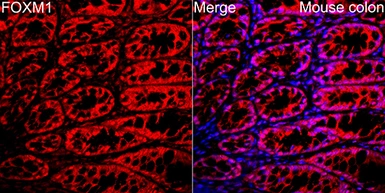 Anti-FOXM1 antibody used in IHC (Paraffin sections) (IHC-P). GTX55627