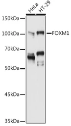 Anti-FOXM1 antibody used in Western Blot (WB). GTX55627