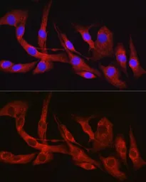 Anti-Furin antibody used in Immunocytochemistry/ Immunofluorescence (ICC/IF). GTX55628