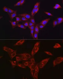 Anti-Furin antibody used in Immunocytochemistry/ Immunofluorescence (ICC/IF). GTX55628