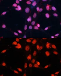 Anti-FUS antibody used in Immunocytochemistry/ Immunofluorescence (ICC/IF). GTX55629