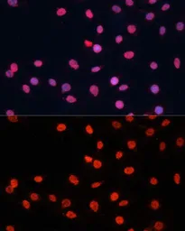 Anti-FUS antibody used in Immunocytochemistry/ Immunofluorescence (ICC/IF). GTX55629