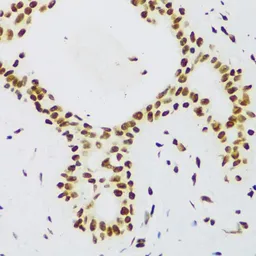 Anti-FUS antibody used in IHC (Paraffin sections) (IHC-P). GTX55629