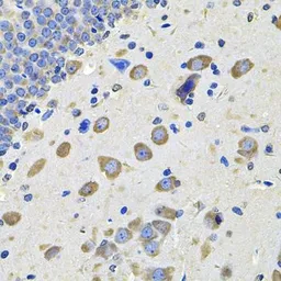 Anti-GALNT2 antibody used in IHC (Paraffin sections) (IHC-P). GTX55634