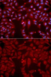 Anti-GluR6 antibody used in Immunocytochemistry/ Immunofluorescence (ICC/IF). GTX55640