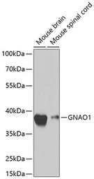 Anti-GNAO1 antibody used in Western Blot (WB). GTX55644