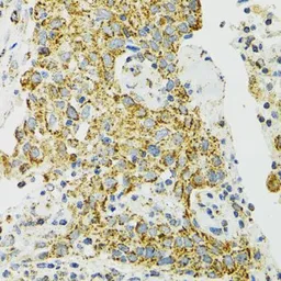 Anti-Grp75 antibody used in IHC (Paraffin sections) (IHC-P). GTX55649