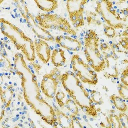Anti-Grp75 antibody used in IHC (Paraffin sections) (IHC-P). GTX55649