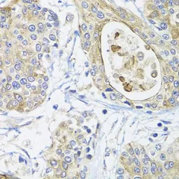 Anti-GSTA2 antibody used in IHC (Paraffin sections) (IHC-P). GTX55651