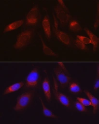 Anti-Hexokinase II antibody used in Immunocytochemistry/ Immunofluorescence (ICC/IF). GTX55657