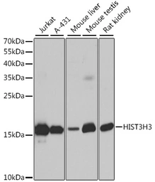 Anti-Histone H3 antibody used in Western Blot (WB). GTX55659