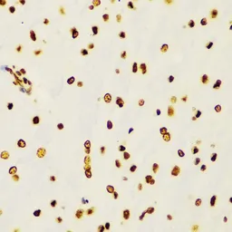 Anti-Histone H3K4me2 (di-methyl Lys4) antibody used in IHC (Paraffin sections) (IHC-P). GTX55660