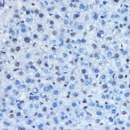 Anti-HP1 gamma antibody used in IHC (Paraffin sections) (IHC-P). GTX55664