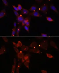 Anti-IKK epsilon antibody used in Immunocytochemistry/ Immunofluorescence (ICC/IF). GTX55673