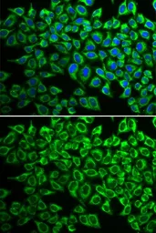 Anti-IL12 Receptor beta1 antibody used in Immunocytochemistry/ Immunofluorescence (ICC/IF). GTX55677