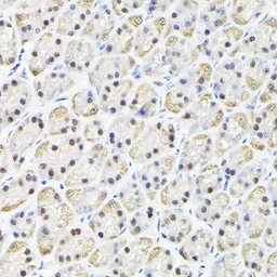 Anti-KPNA3 antibody used in IHC (Paraffin sections) (IHC-P). GTX55685