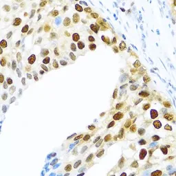 Anti-KHDRBS2 antibody used in IHC (Paraffin sections) (IHC-P). GTX55686