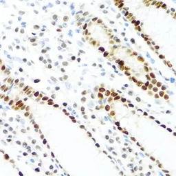 Anti-KHDRBS2 antibody used in IHC (Paraffin sections) (IHC-P). GTX55686