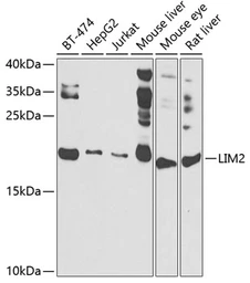 Anti-LIM2 antibody used in Western Blot (WB). GTX55691