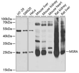 Anti-MSRA antibody used in Western Blot (WB). GTX55713