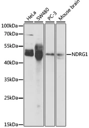 Anti-NDRG1 antibody used in Western Blot (WB). GTX55721