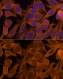 Anti-nm23-H1 antibody used in Immunocytochemistry/ Immunofluorescence (ICC/IF). GTX55727