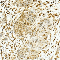 Anti-NRF2 antibody used in IHC (Paraffin sections) (IHC-P). GTX55732