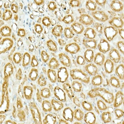 Anti-NRF2 antibody used in IHC (Paraffin sections) (IHC-P). GTX55732
