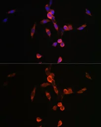 Anti-PI3 kinase p110 alpha antibody used in Immunocytochemistry/ Immunofluorescence (ICC/IF). GTX55747