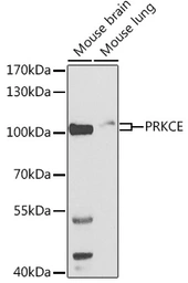 Anti-PKC epsilon antibody used in Western Blot (WB). GTX55749