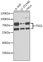 Anti-PSG1 antibody used in Western Blot (WB). GTX55761