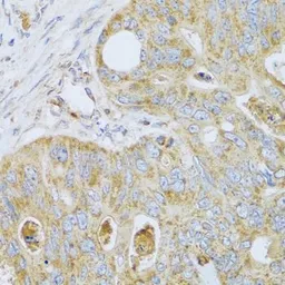 Anti-PSG1 antibody used in IHC (Paraffin sections) (IHC-P). GTX55761