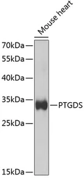 Anti-PTGDS antibody used in Western Blot (WB). GTX55765