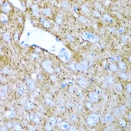 Anti-PTGDS antibody used in IHC (Paraffin sections) (IHC-P). GTX55765