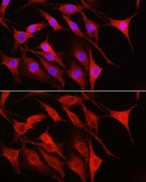 Anti-Rac1 antibody used in Immunocytochemistry/ Immunofluorescence (ICC/IF). GTX55772