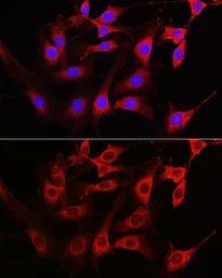 Anti-Rac1 antibody used in Immunocytochemistry/ Immunofluorescence (ICC/IF). GTX55772