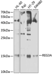 Anti-REG III alpha antibody used in Western Blot (WB). GTX55778