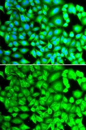 Anti-REG III alpha antibody used in Immunocytochemistry/ Immunofluorescence (ICC/IF). GTX55778