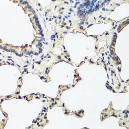 Anti-REG III alpha antibody used in IHC (Paraffin sections) (IHC-P). GTX55778