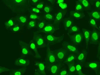 Anti-RFC1 antibody used in Immunocytochemistry/ Immunofluorescence (ICC/IF). GTX55779