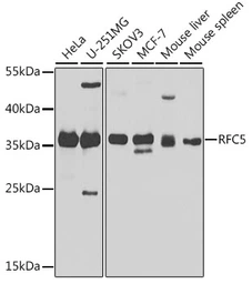 Anti-RFC5 antibody used in Western Blot (WB). GTX55780