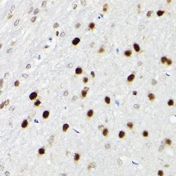 Anti-SATB1 antibody used in IHC (Paraffin sections) (IHC-P). GTX55787