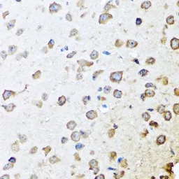 Anti-SERPINA10 antibody used in IHC (Paraffin sections) (IHC-P). GTX55791