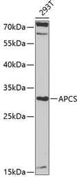 Anti-Serum Amyloid P antibody used in Western Blot (WB). GTX55792