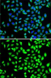 Anti-SGTA antibody used in Immunocytochemistry/ Immunofluorescence (ICC/IF). GTX55797