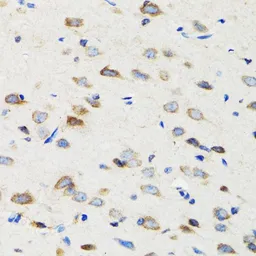 Anti-SIAH1 antibody used in IHC (Paraffin sections) (IHC-P). GTX55799