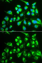 Anti-SLC22A5 antibody used in Immunocytochemistry/ Immunofluorescence (ICC/IF). GTX55800